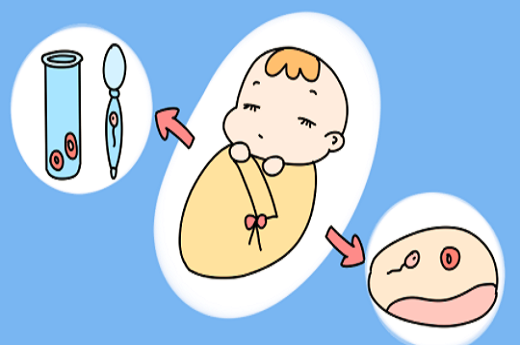 试管婴儿一般移植什么胚胎好些