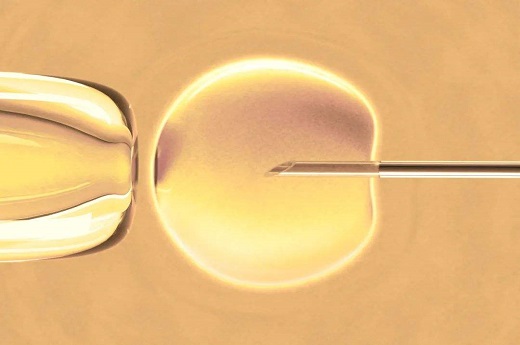 试管婴儿移植鲜胚时要注意什么
