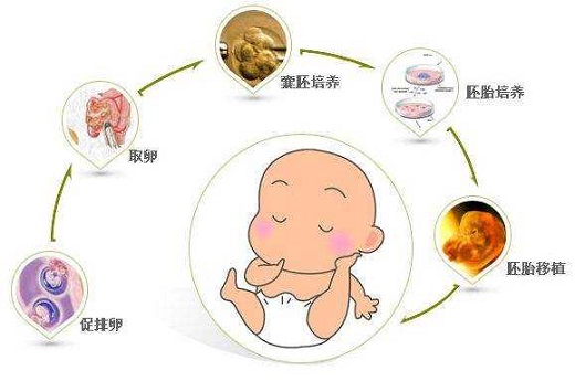 渭南二代试管婴儿流程